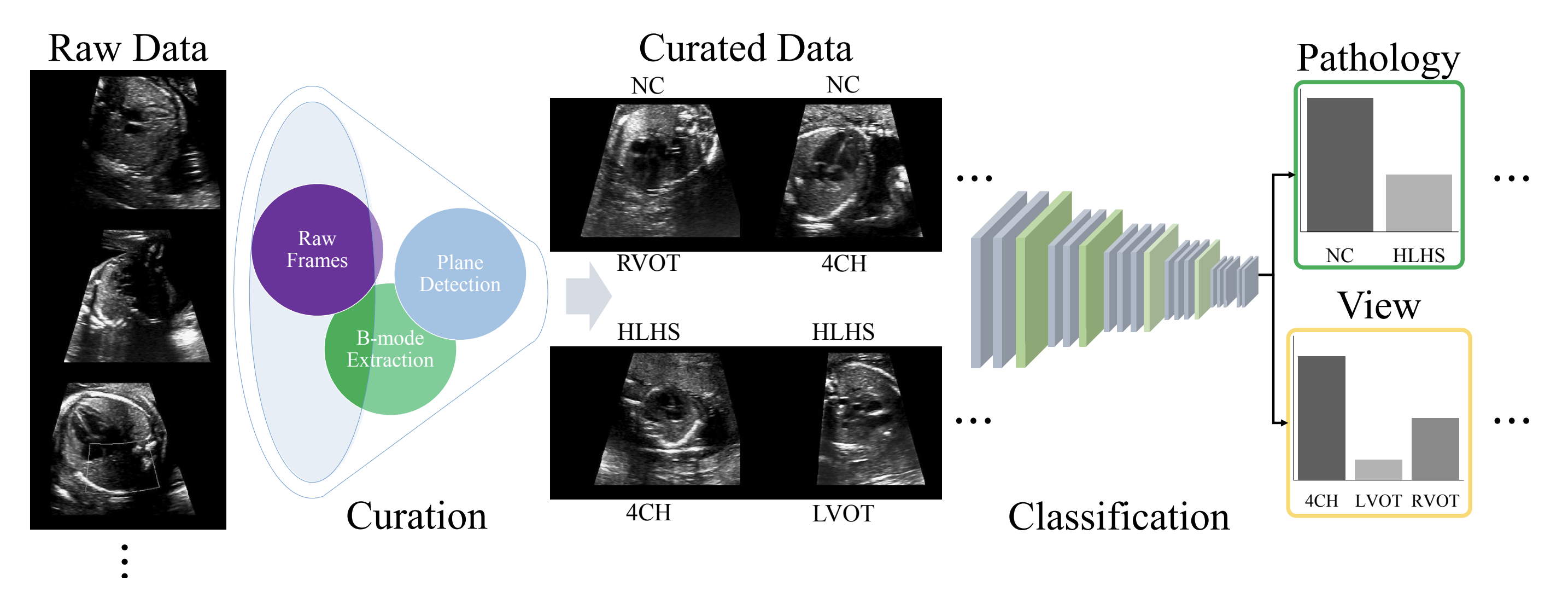 Automated Detection of Congenital Heart Disease in Fetal Ultrasound Screening