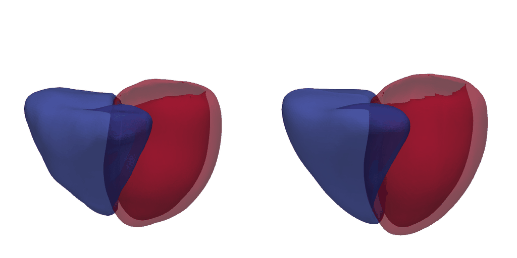 Digital Hearts for Personalized Cardiac Care